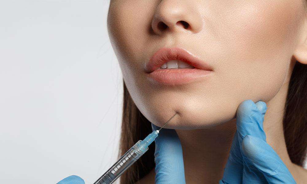 chin filler