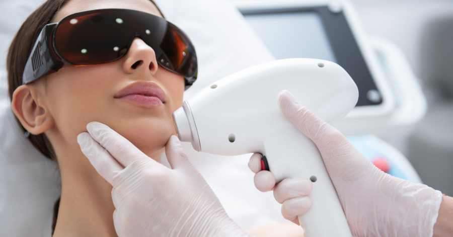 CO2 Fractional laser